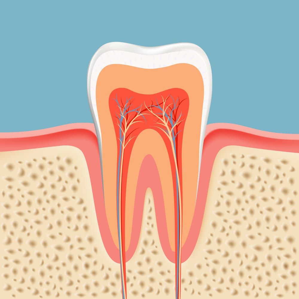 Root Canals in Pittsburgh, PA